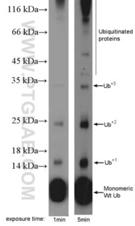 <ul><li><p><span>in the 1 minutes exposure time you can see there are already Ub+2 and then after 5 minutes you can see that Ub+3 if not more than that…eventually the levels kind drop off as that the protein starts to get degraded…this shows that Ub gets ADDED to the protein…this shows how we can understand Ub and degradation&nbsp;</span></p></li><li><p><span>this is how the cell knows that a protein needs to get degradation&nbsp;</span></p></li></ul><p></p>