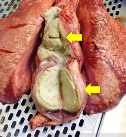 <p>What is a likely cause of the pathology in this case?</p>