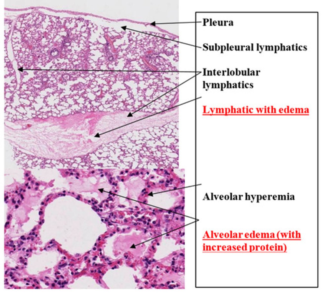 <p>What is the lesion?</p>