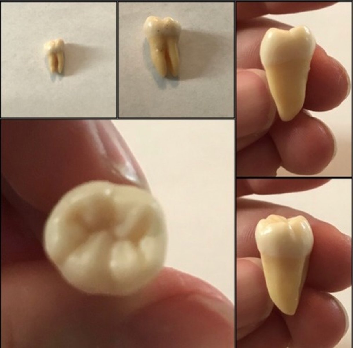 <p>What tooth is this ?</p>