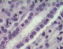 <p>Single layer of tall cells; involved in absorption and secretion; ciliated form propels mucus.</p>