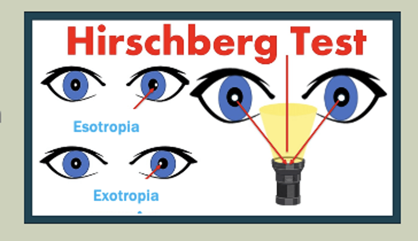 <p>-Have pt look at light that is equally projected between 2 eyes</p><p>-Look for symmetry at the reflected reflex on cornea</p><p>-If reflex is temporal: Esotropic</p><p>-If reflex is nasal: Exotropic</p>