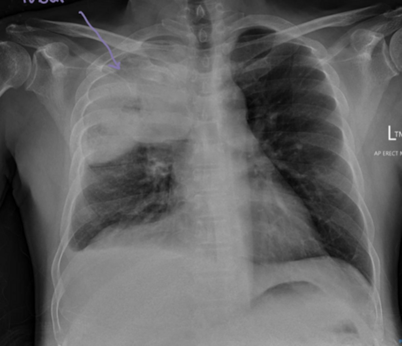 <p>Name the condition</p>