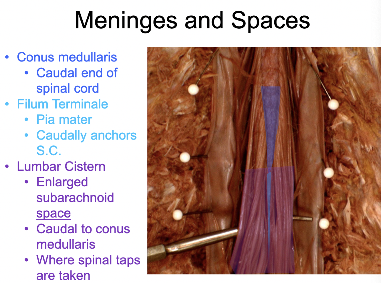 <p>Lumbar cistern space: holds cerebrospinal fluid (CSF), where spinal taps occur</p>