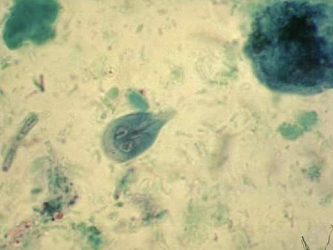 <p>Identify: Protozoa</p>