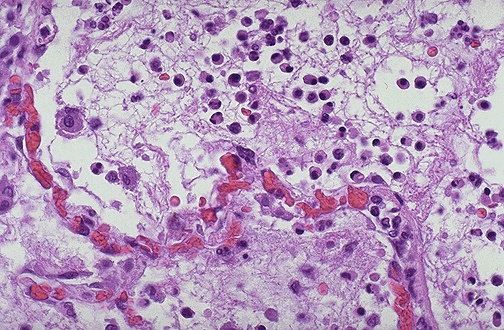 <ol><li><p>Identify </p></li><li><p>Describe the series of events in acute inflammation</p></li></ol>