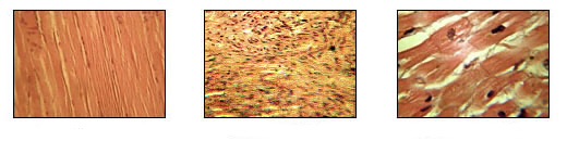 <p>Muscle Tissue</p>