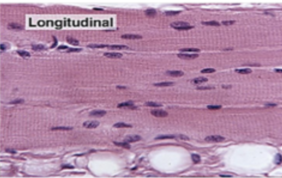 <p>histological appearance of longitudinal skeletal muscle</p>