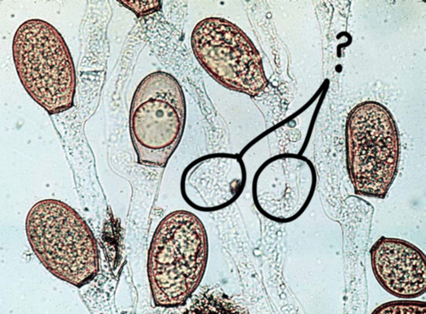 <p>Interconnected network of hyphae</p>