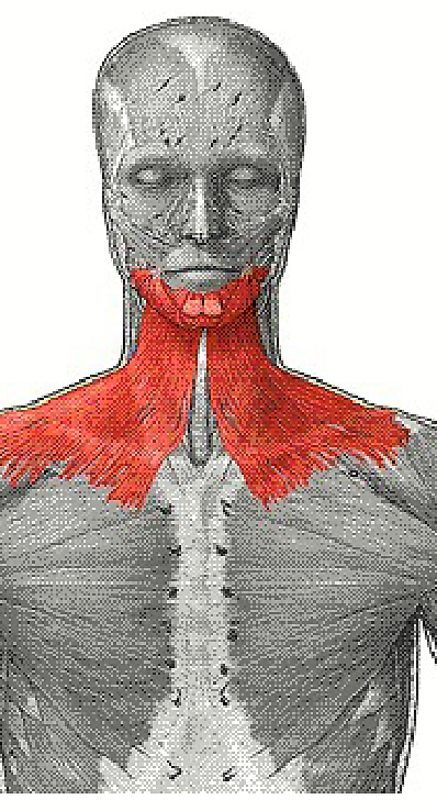 <p>Origin: fascia of chest Insertion: lower margin of mandible Action: Tenses skin of neck, pulls lower lip back and down (downward sag of mouth)</p>