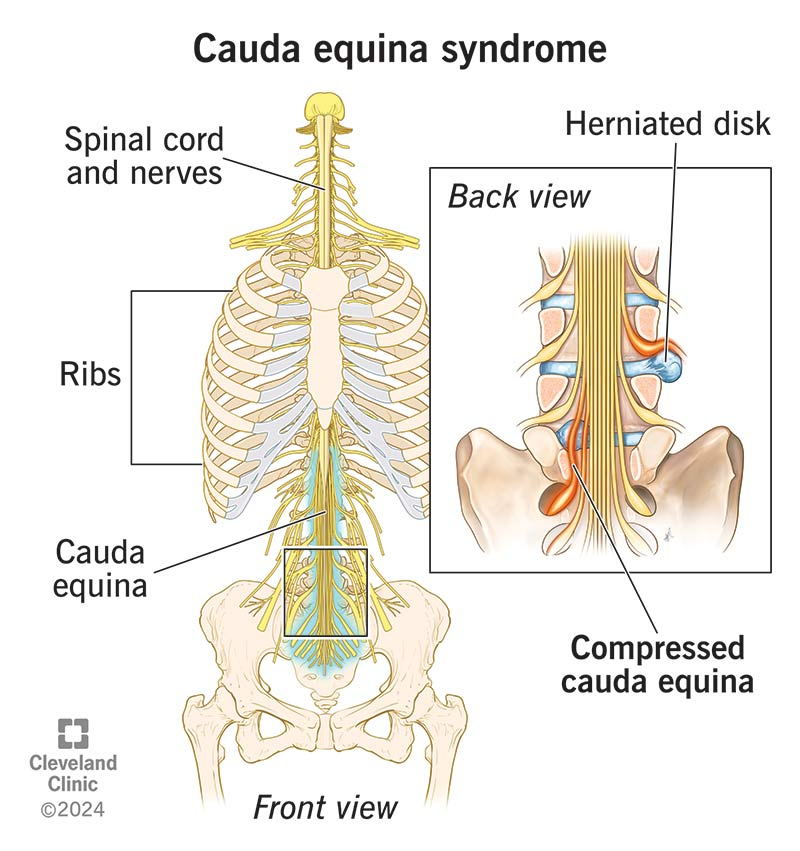 <p>A collection of spinal nerves and nerve roots that extend from the end of the spinal cord, typically at the L1-L2 level, and continue downwards within the lumbar and sacral regions of the vertebral canal</p>