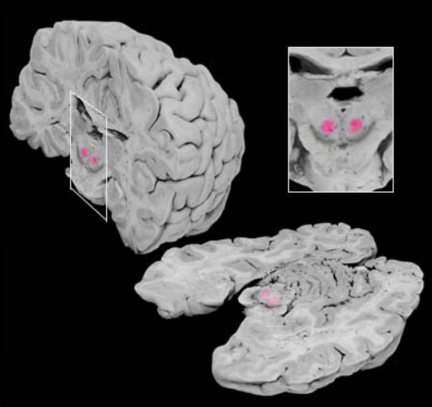 <p>Red nucleus</p>