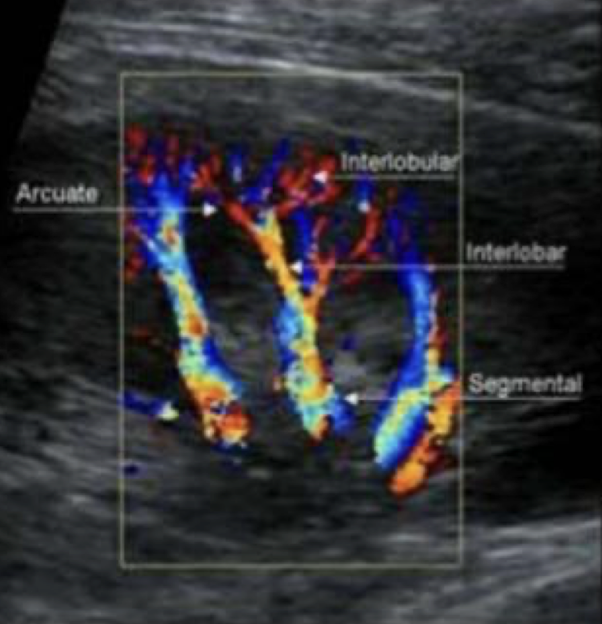 <p>M.S.I.A.I.</p><ul><li><p><mark data-color="yellow" style="background-color: yellow; color: inherit;">main renal</mark> artery</p></li><li><p><mark data-color="yellow" style="background-color: yellow; color: inherit;">segmental renal</mark> artery</p><ul><li><p>at <u>hilum</u></p></li></ul></li><li><p><mark data-color="yellow" style="background-color: yellow; color: inherit;">interlobar</mark> arteries</p><ul><li><p>between/<u>along pyramids</u></p></li></ul></li><li><p><mark data-color="yellow" style="background-color: yellow; color: inherit;">arcuate</mark> arteries</p><ul><li><p>at <u>base</u> of pyramids</p></li></ul></li><li><p><mark data-color="yellow" style="background-color: yellow; color: inherit;">interlobular</mark> arteries</p><ul><li><p>near <u>edge of cortex</u></p></li></ul></li></ul><p></p>