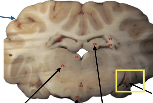 <p>What is this highlighted figure?</p>