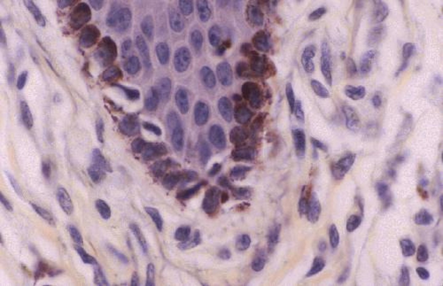 <p>Spidery black cells that produce the brown-to-black pigment called melanin.</p>