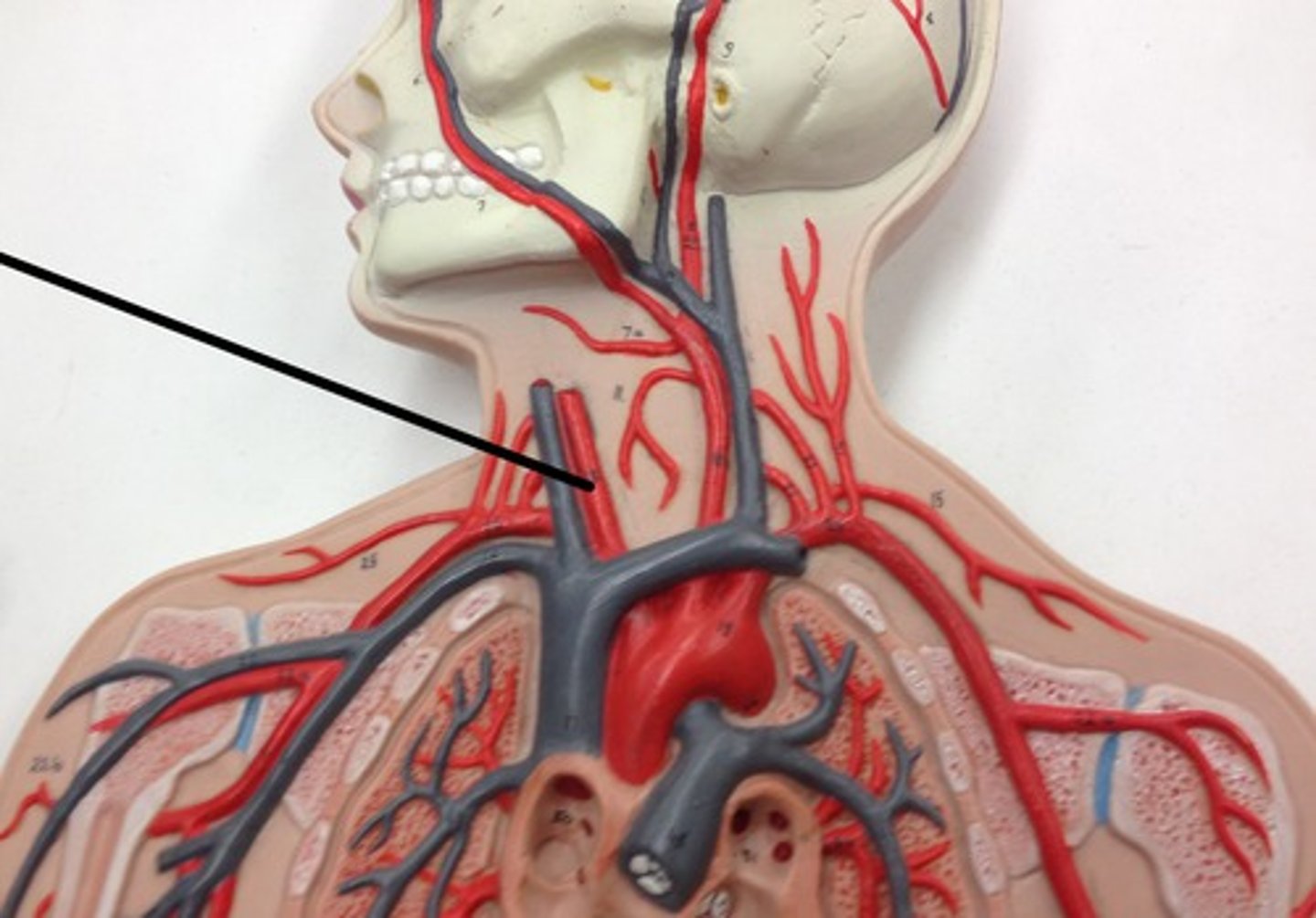 <p>What structure?</p>