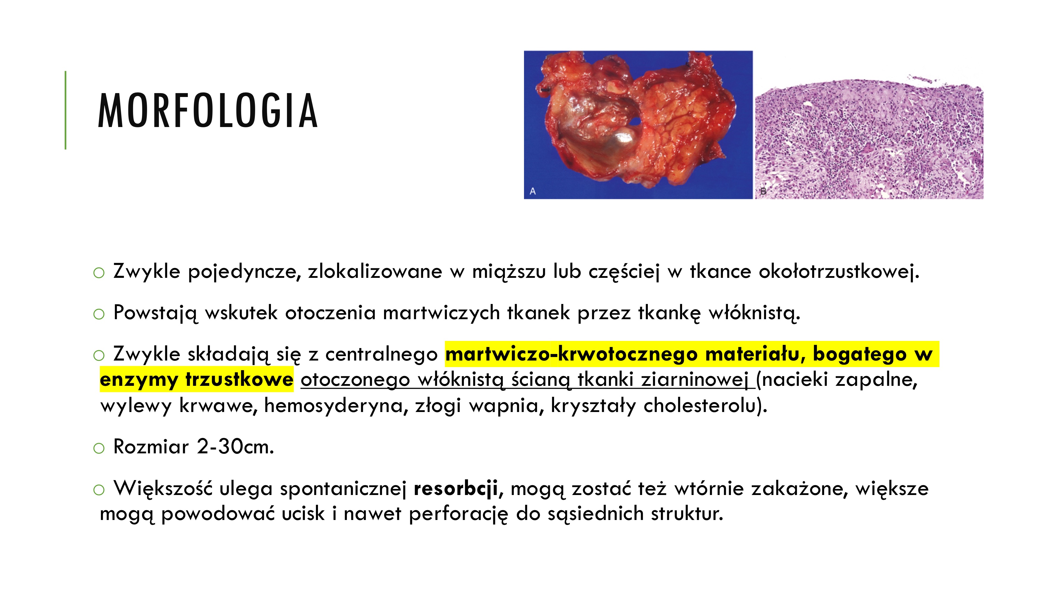 <p>v Zlokalizowane nagromadzenie martwiczo-krwotocznego</p><p>materiału bogatego w enzymy.</p><p>v 75% torbieli trzustki</p><p>v Zwykle powstają po epizodzie OZT, często w alkoholizmie.</p><p>Mogą powstawać także pourazowo</p><p></p><p>MORFOLOGIA</p><p>o Zwykle pojedyncze, zlokalizowane w miąższu lub częściej w tkance okołotrzustkowej.</p><p>o Powstają wskutek otoczenia martwiczych tkanek przez tkankę włóknistą.</p><p>o Zwykle składają się z centralnego martwiczo-krwotocznego materiału, bogatego w</p><p>enzymy trzustkowe otoczonego włóknistą ścianą tkanki ziarninowej (nacieki zapalne,</p><p>wylewy krwawe, hemosyderyna, złogi wapnia, kryształy cholesterolu).</p><p>o Rozmiar 2-30cm.</p><p>o Większość ulega spontanicznej resorbcji, mogą zostać też wtórnie zakażone, większe</p><p>mogą powodować ucisk i nawet perforację do sąsiednich struktur</p>