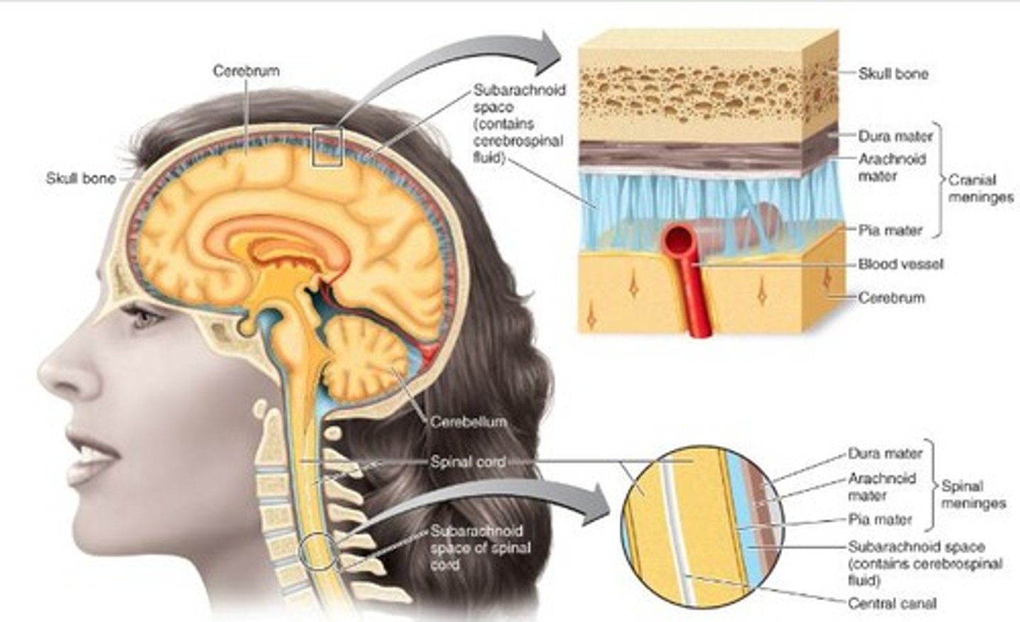 <p>inflammation of both meninges and brain</p>