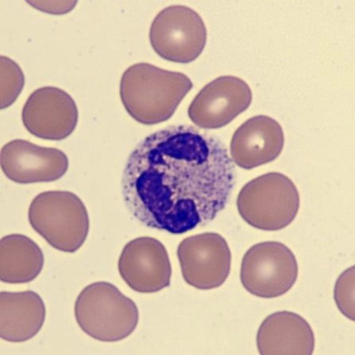 <p>What is this leukocyte?</p>