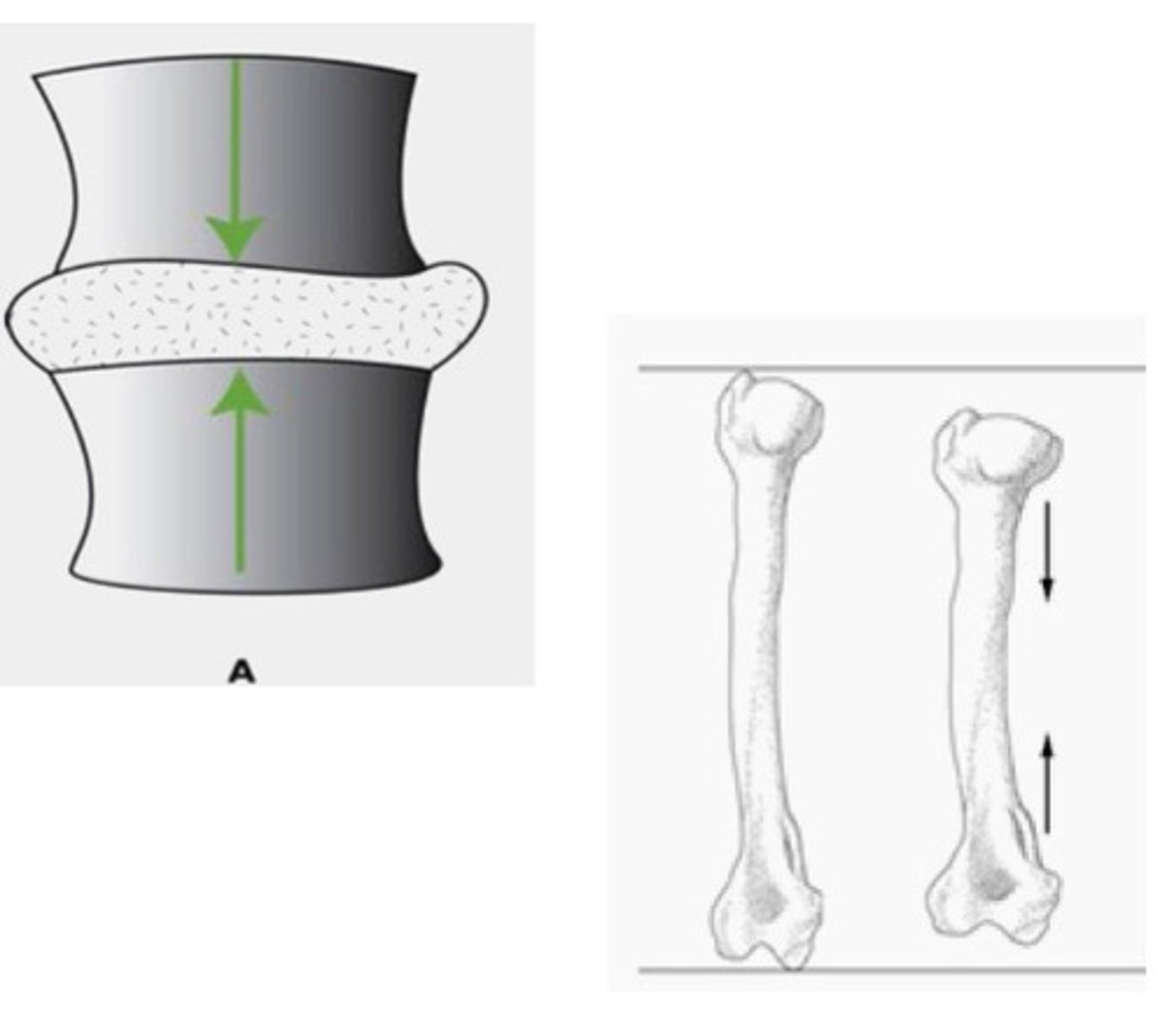 <p>Force applied in perpendicular directions; can press bones together; weight bearing, gravity, external load</p>