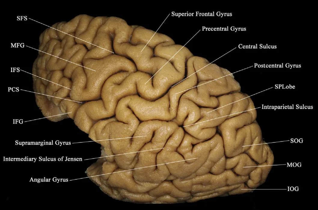 <p>prominent groove on the surface of the brain that separates the frontal and parietal lobes</p>