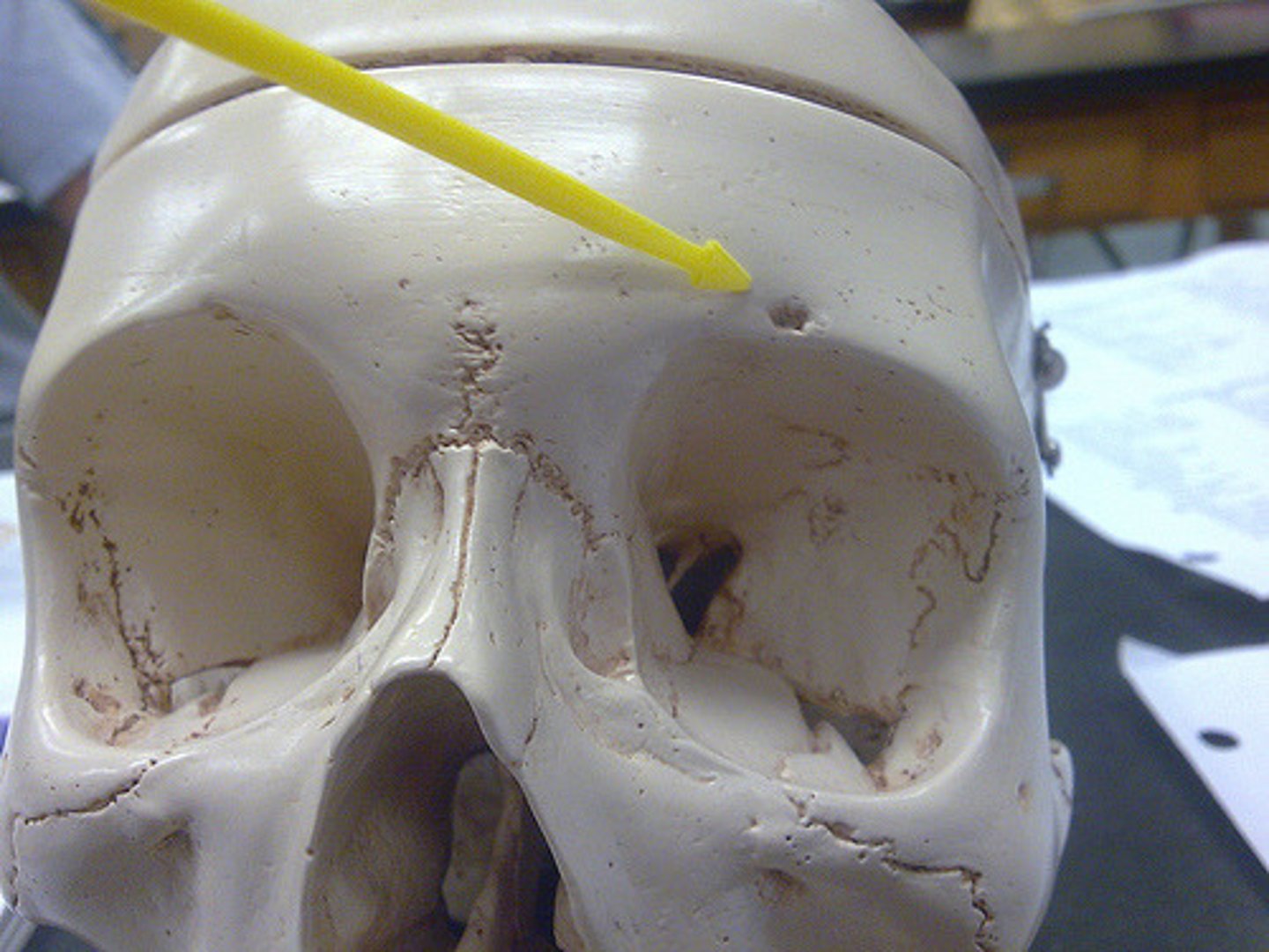 <p>hole</p><p>notch above the eye socket</p>