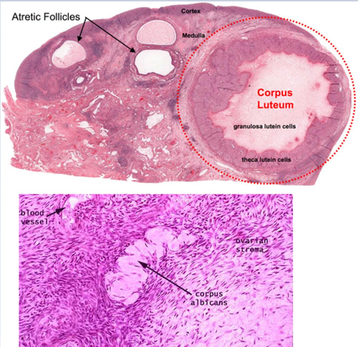 <p>Structure that produces progesterone after ovulation.</p>
