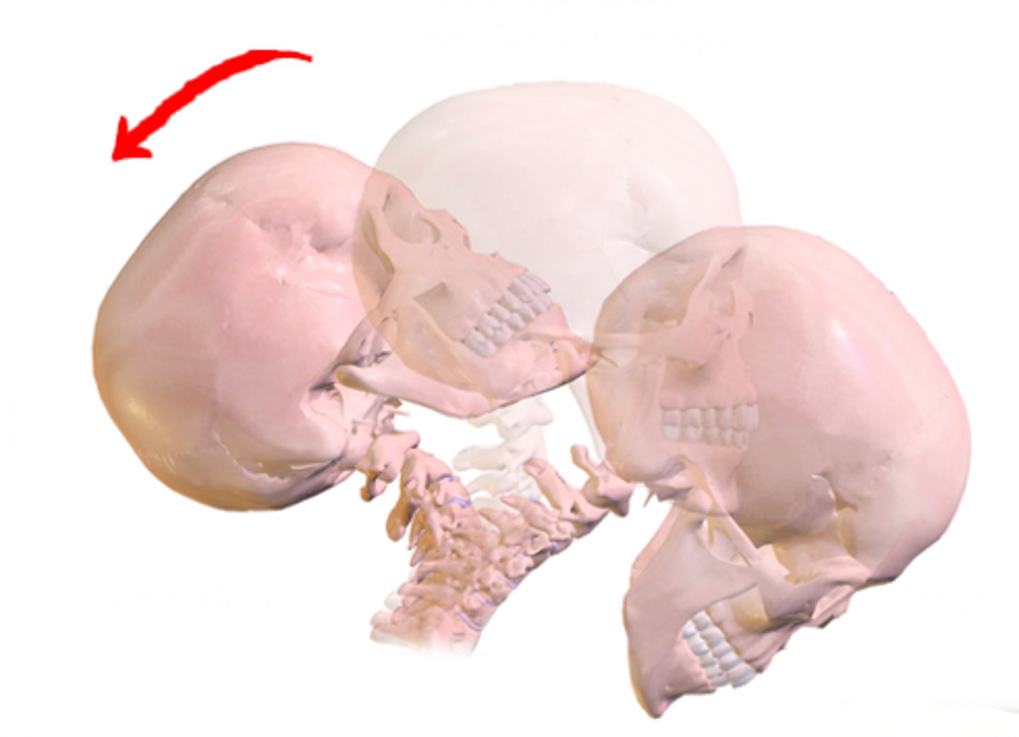 <p>Identify the action indicated by the arrow</p>