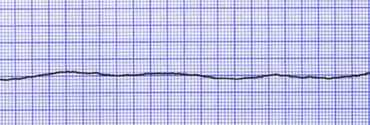 <p>Name the rhythm</p>