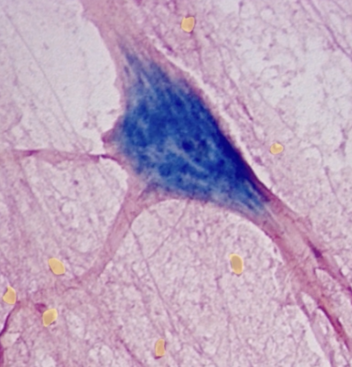 <p>What type of cell is highlighted in yellow?</p>