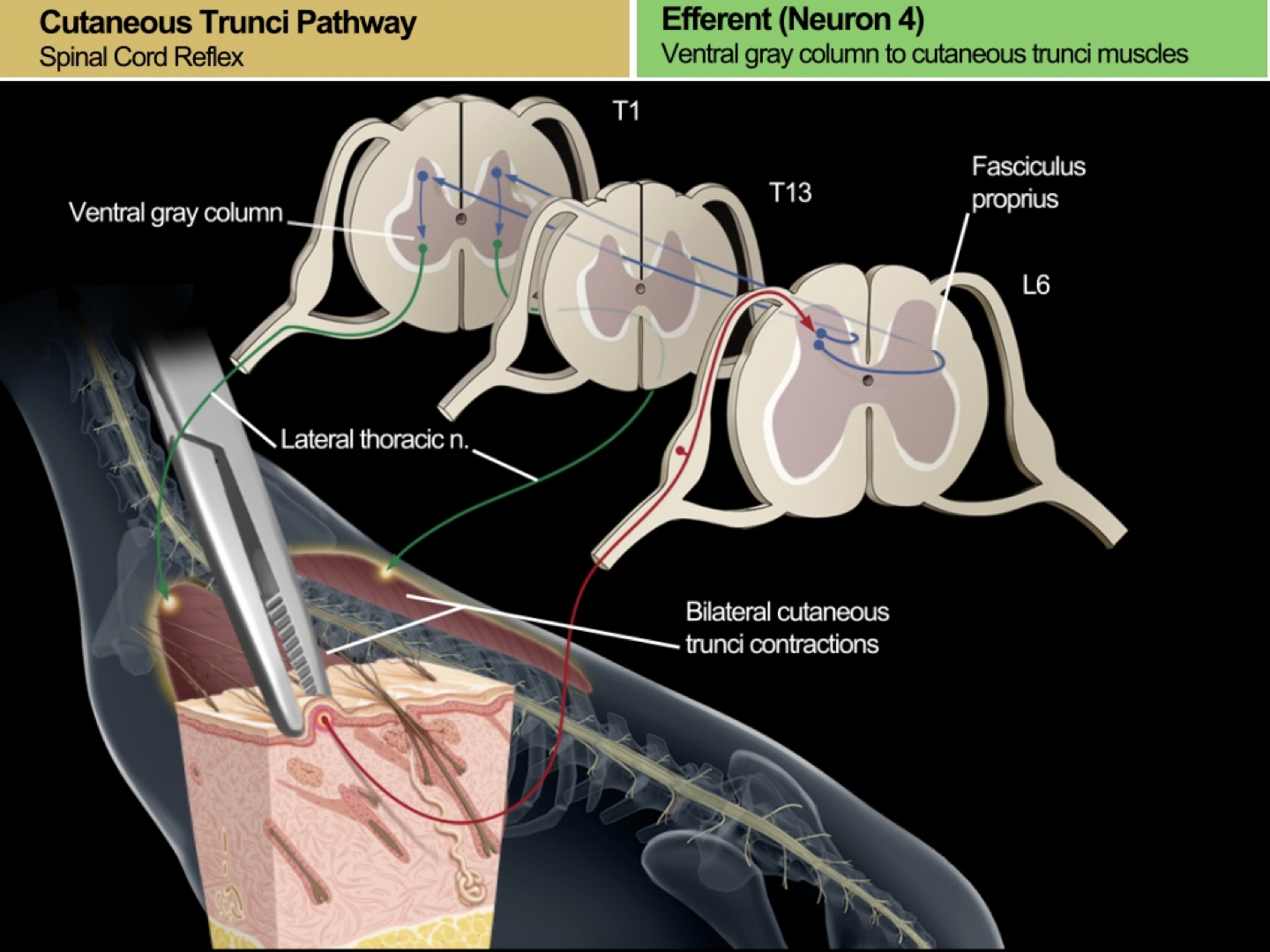 <p>Nociceptor is triggered by pain, and interacts with a pair of <strong>interneurons</strong> once signal travels to the dorsal horn of gray matter</p><ul><li><p>These interneurons actually WRAP AROUND an area of the dorsal horn of gray matter called the<strong> fasciculus proprius,</strong> and travel UP the spine </p></li><li><p>These interneurons then communicate with interneurons in the vertebrae farther up the spine, which send the signal to EFFERENT neurons in the ventral horn</p><ul><li><p>These then send a signal to contract the <strong>dermatome </strong>that they are associated with within the thorax</p></li></ul></li></ul><p></p>