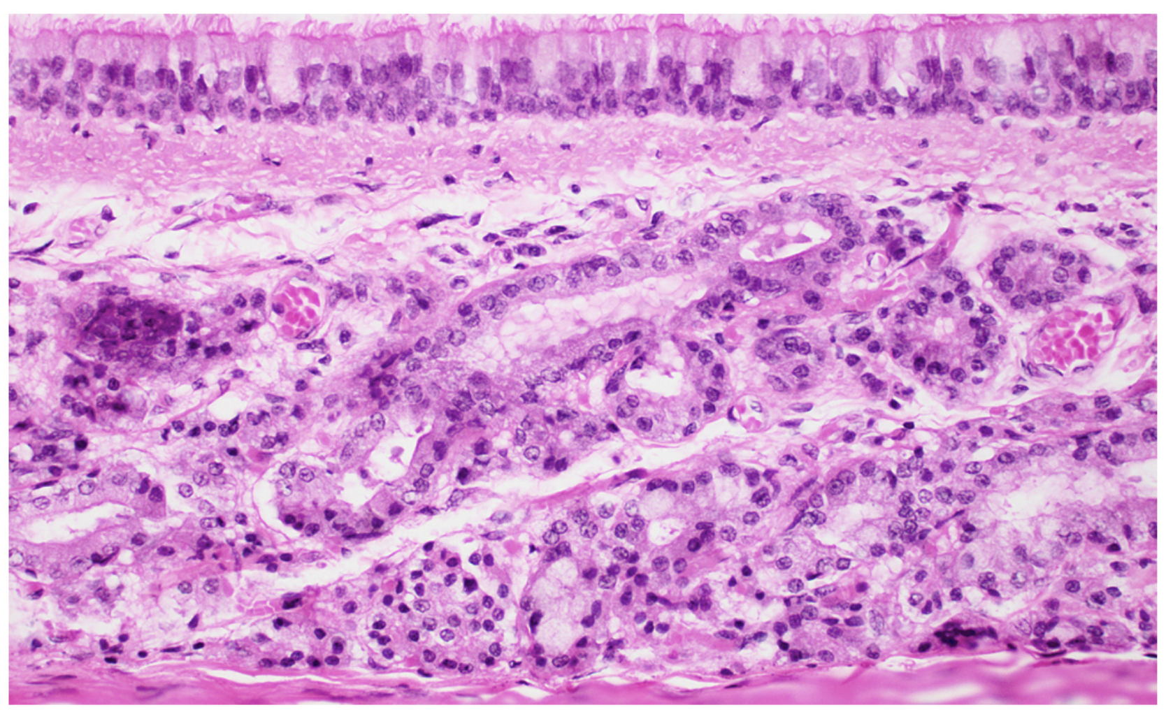 <p>Pseudostratified ciliated columnar epithelium.</p>