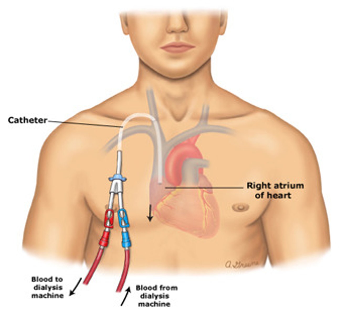 <p>tunneled catheters are usually placed in the ____________, and they may be used after how much time?</p>