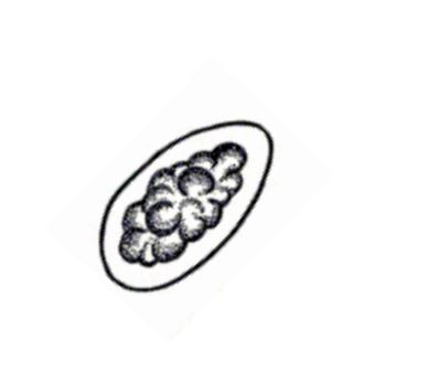 <p>Trichostrongylus</p>