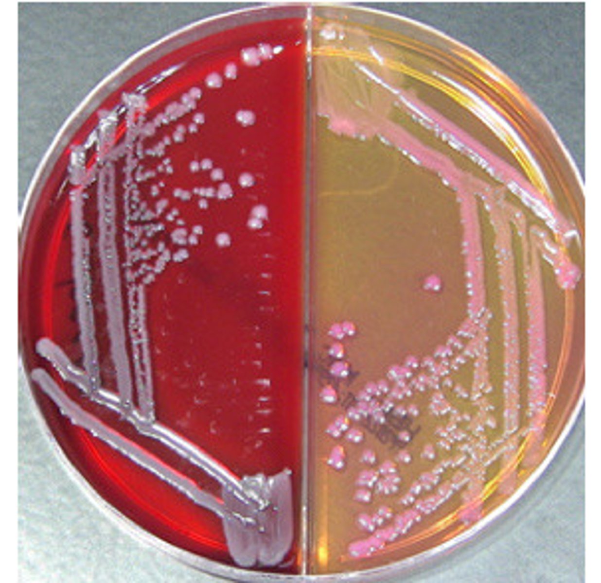 <p>GNB, lactose pos, catalase pos, oxidase neg, indole neg, quite resistant on sensitivity</p>
