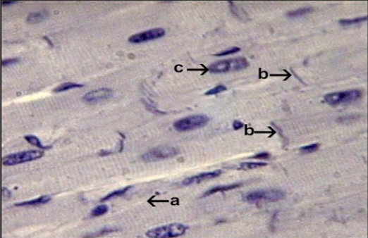<p>Branching striated with intercalated discs</p><p>pumps blood through the body</p><p>located in the walls of the heart</p>
