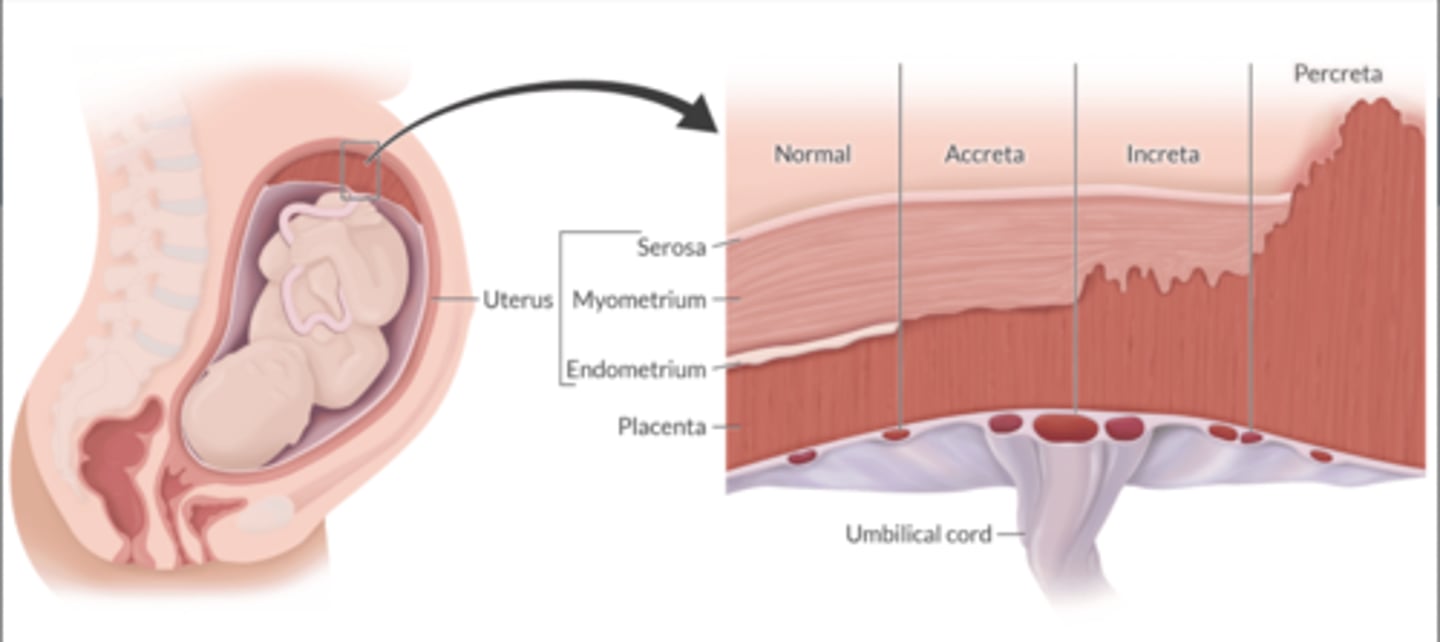 <p>Normal implantation: decider of endometrium.</p><p>A: attaches to the surface of the myometrium</p><p>I: invades the myometrium</p><p>P: extends beyond the uterus</p><p>Uterine contractility is usually impaired</p><p>Potential for tremendous blood loss.</p><p>Neuraxial is safe, GA is preferred</p>