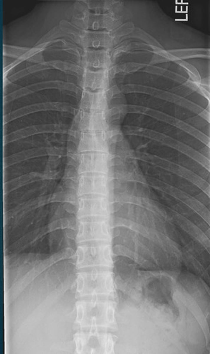 <p>What projection view is this?</p>