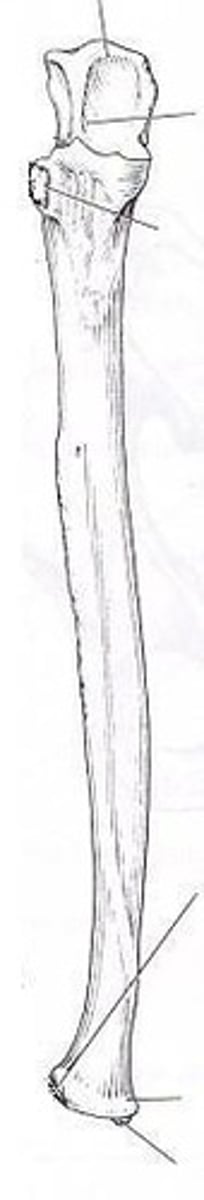 <p>ID bone</p>