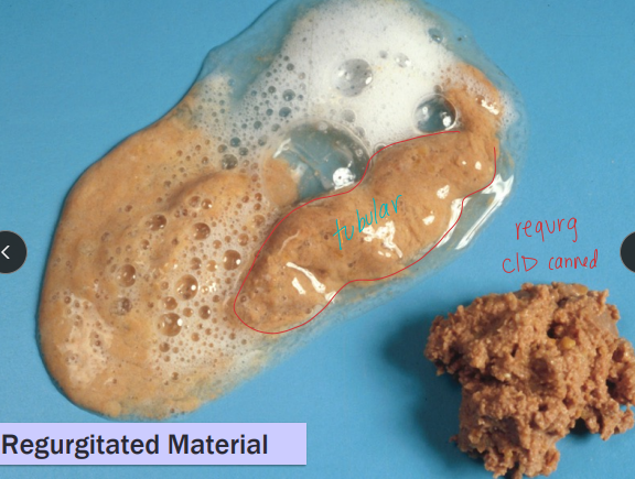 <p><span style="background-color: transparent;"><strong><span>Regurgitation</span></strong></span></p>