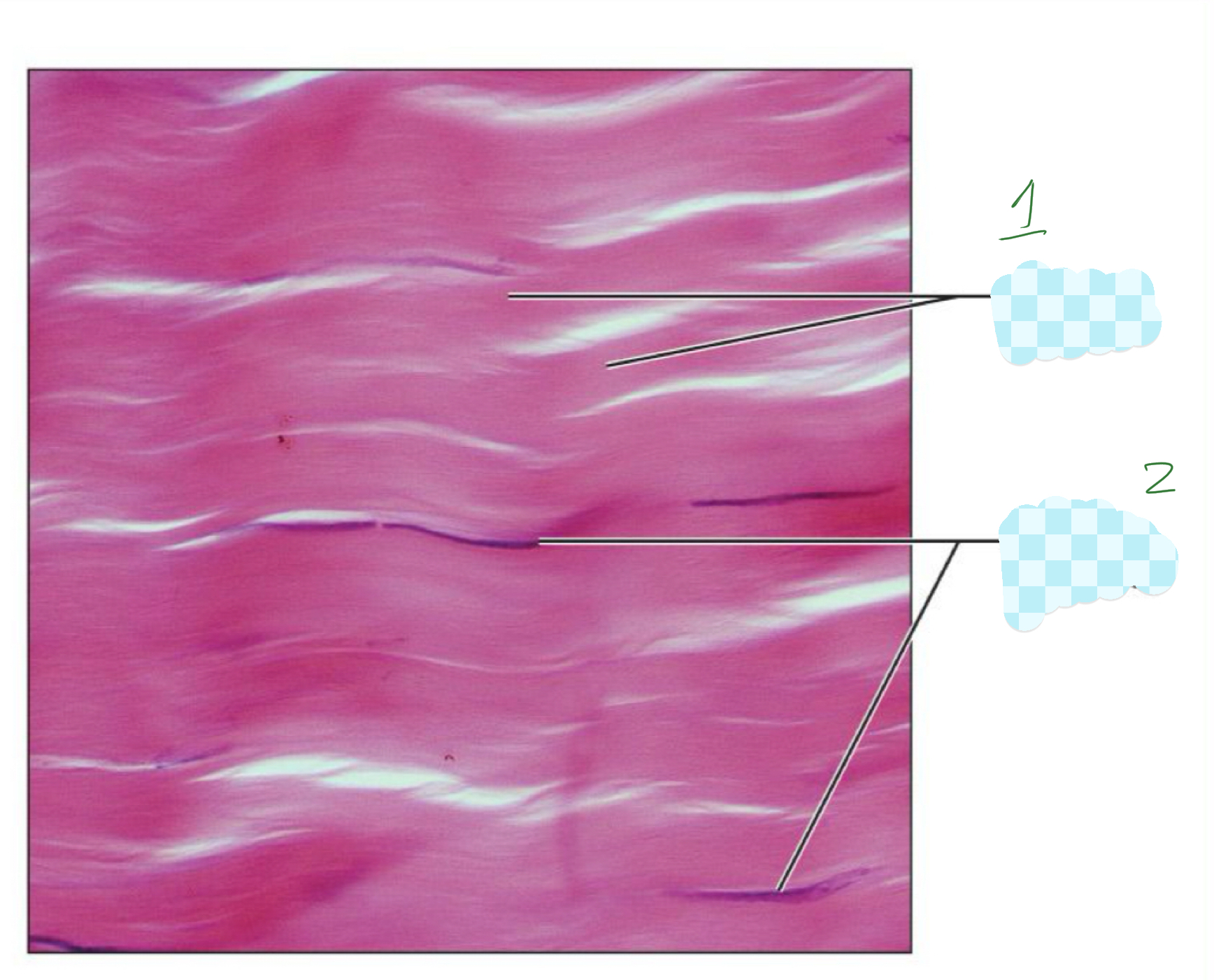 <p>2) regular dense </p>