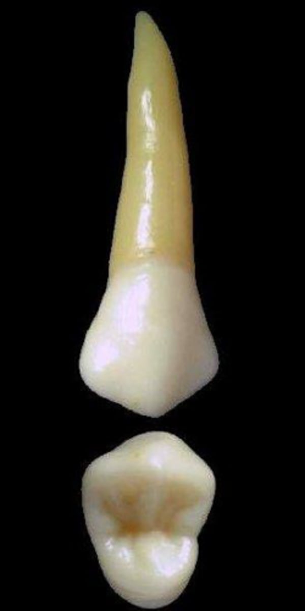 <p>what tooth is this &amp; why?</p>
