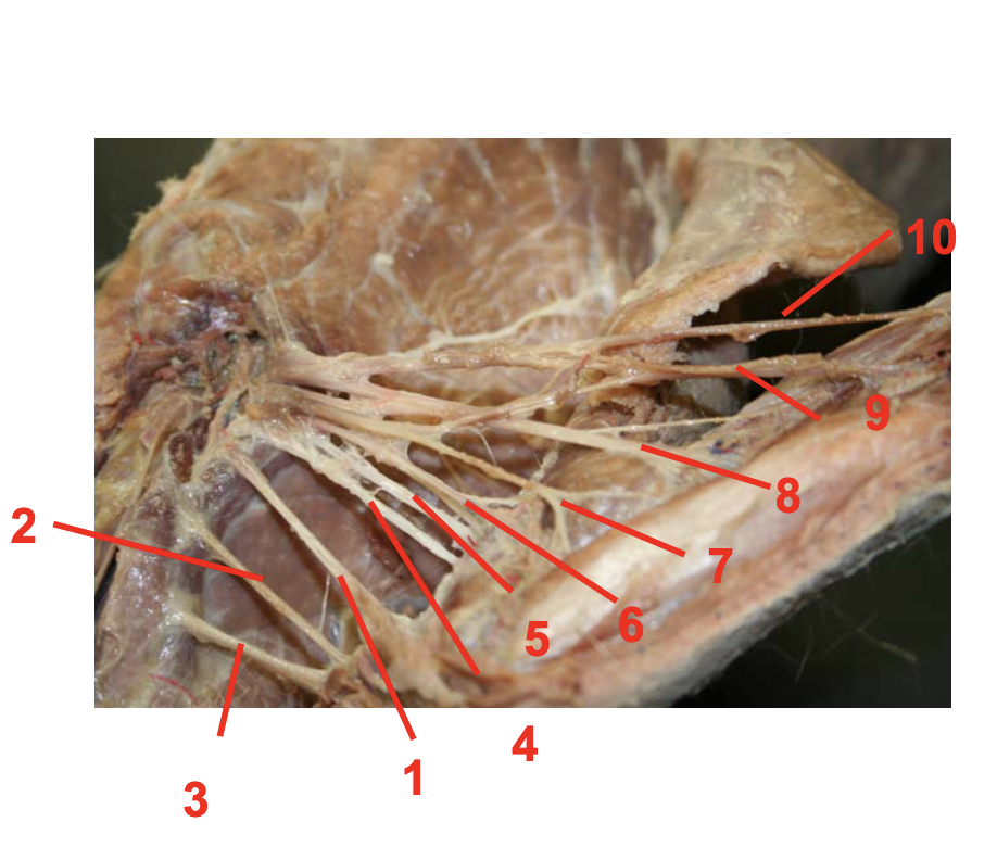 <p>Cervical Nerve 4</p>