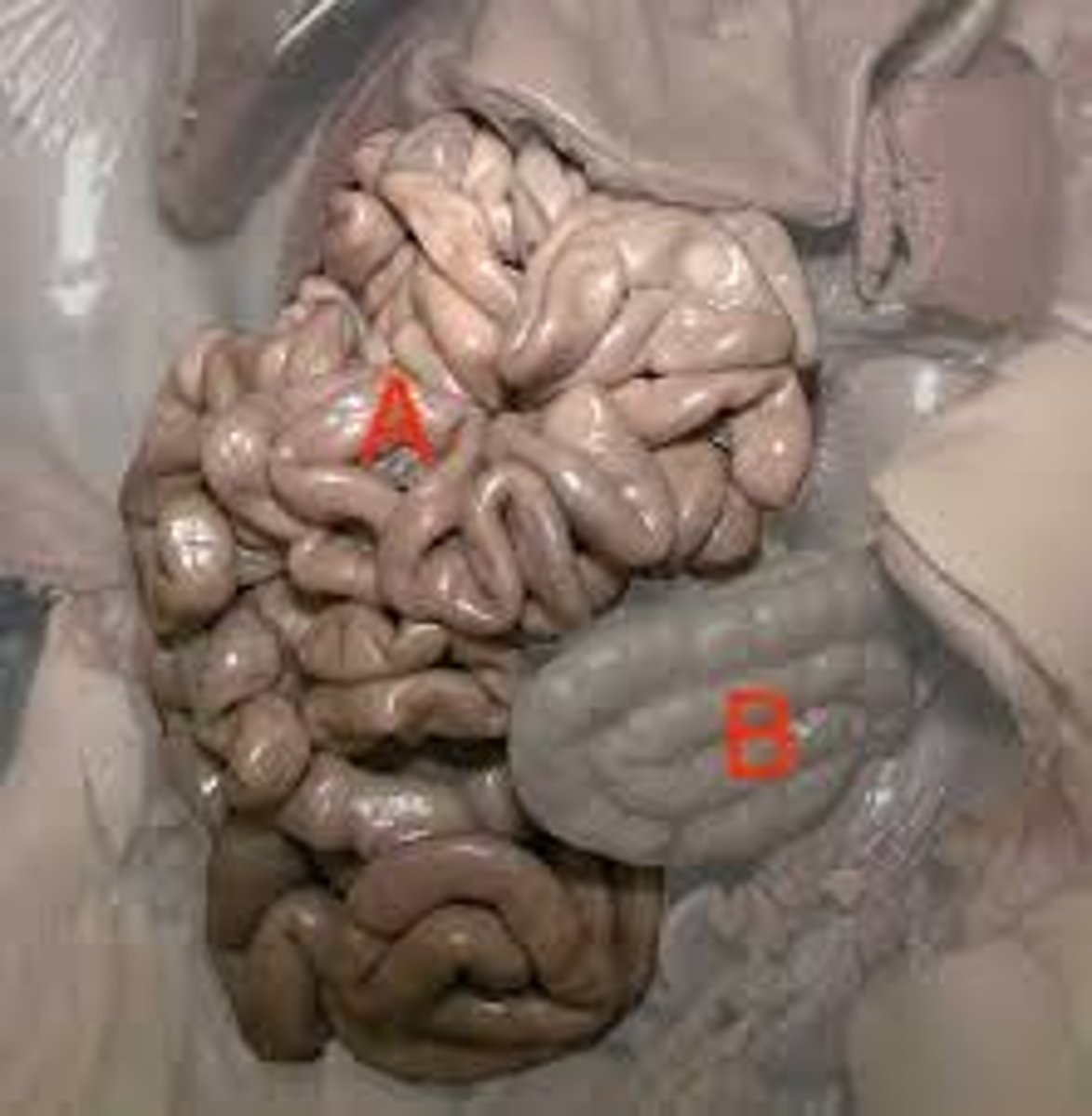 <p>What is the name of this structure? (Letter A)</p>