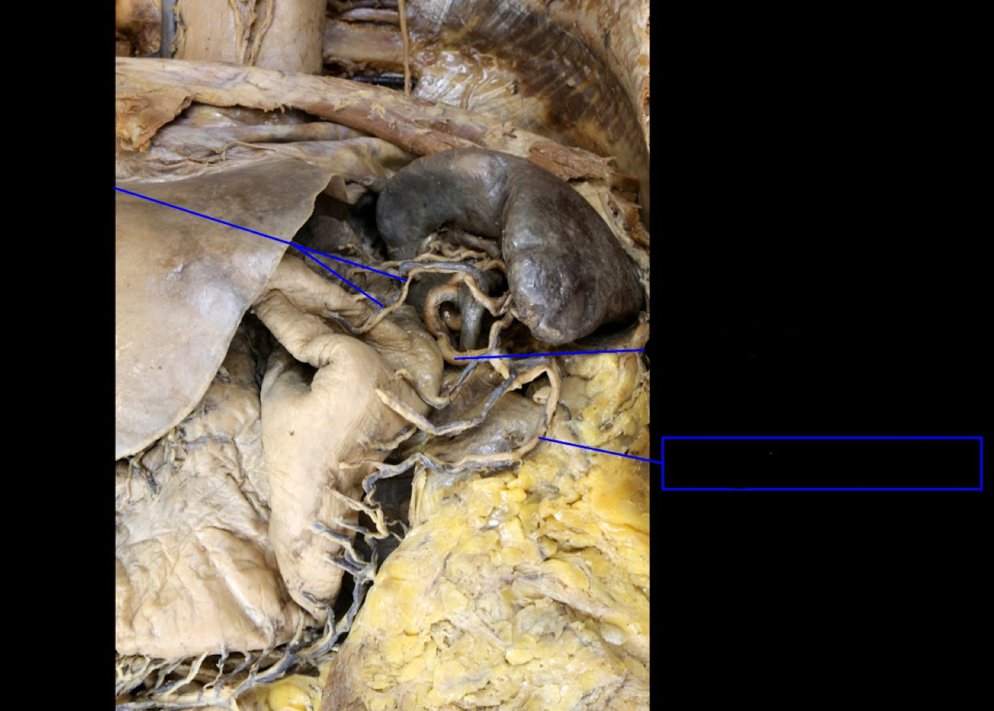 <p>A). Identify this structure<br>B). Which structure is this from?<br>C). What does it supply?</p>