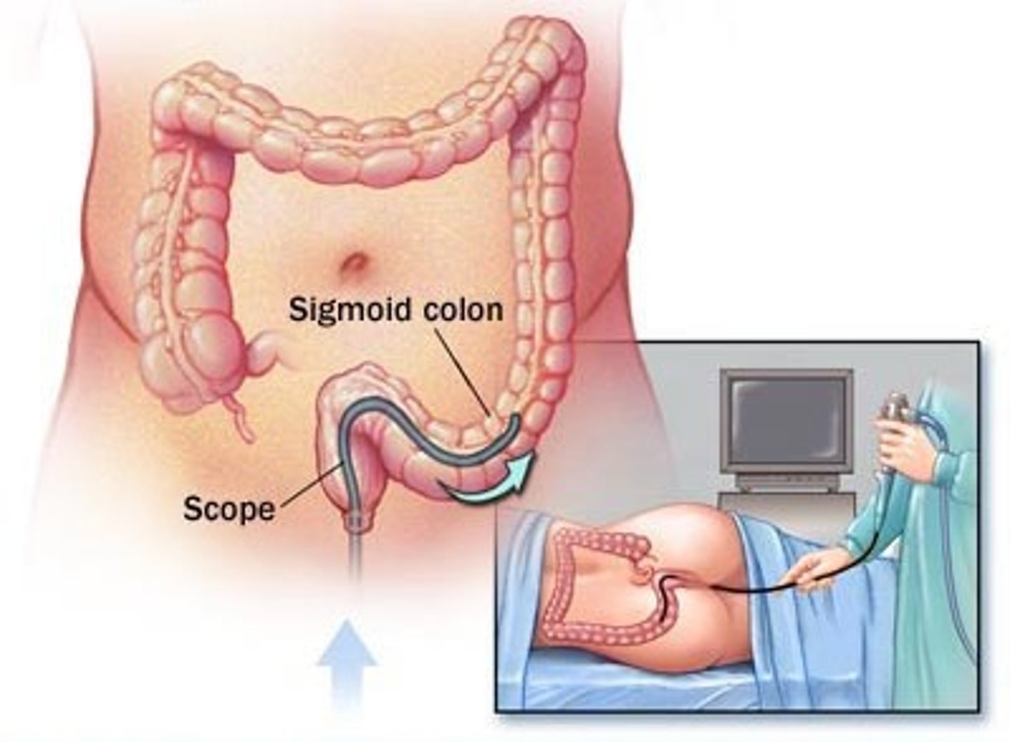 <p>Avoid fish, cantaloupe, turnips, and red meats 48-72 hrs before the procedure.</p>