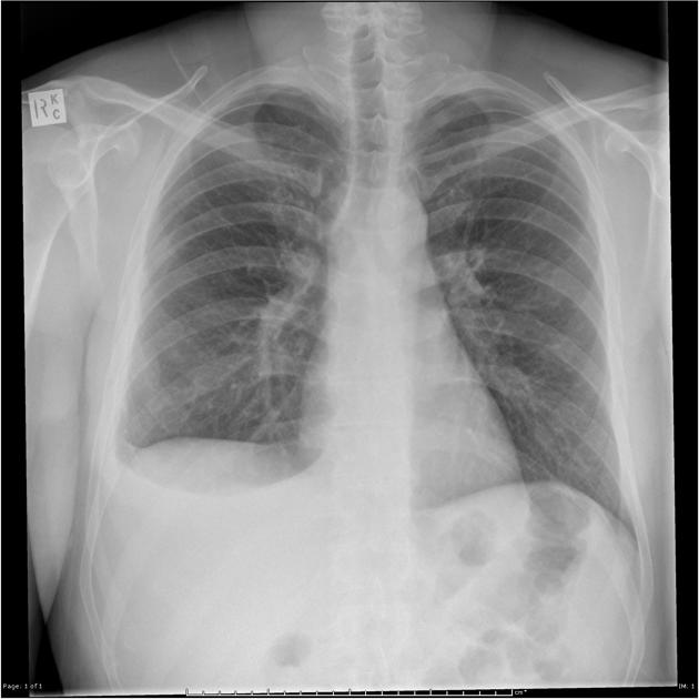 <p>Describe the abnormality demonstrated.</p>