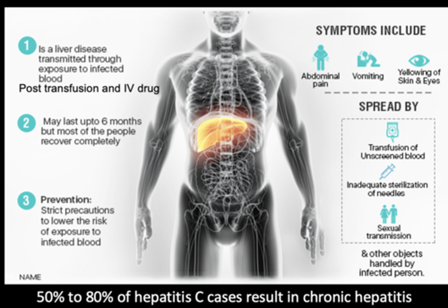 <p>hepatitis C</p>