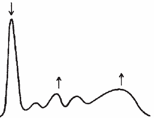 <p>Chronic Inflammation</p>