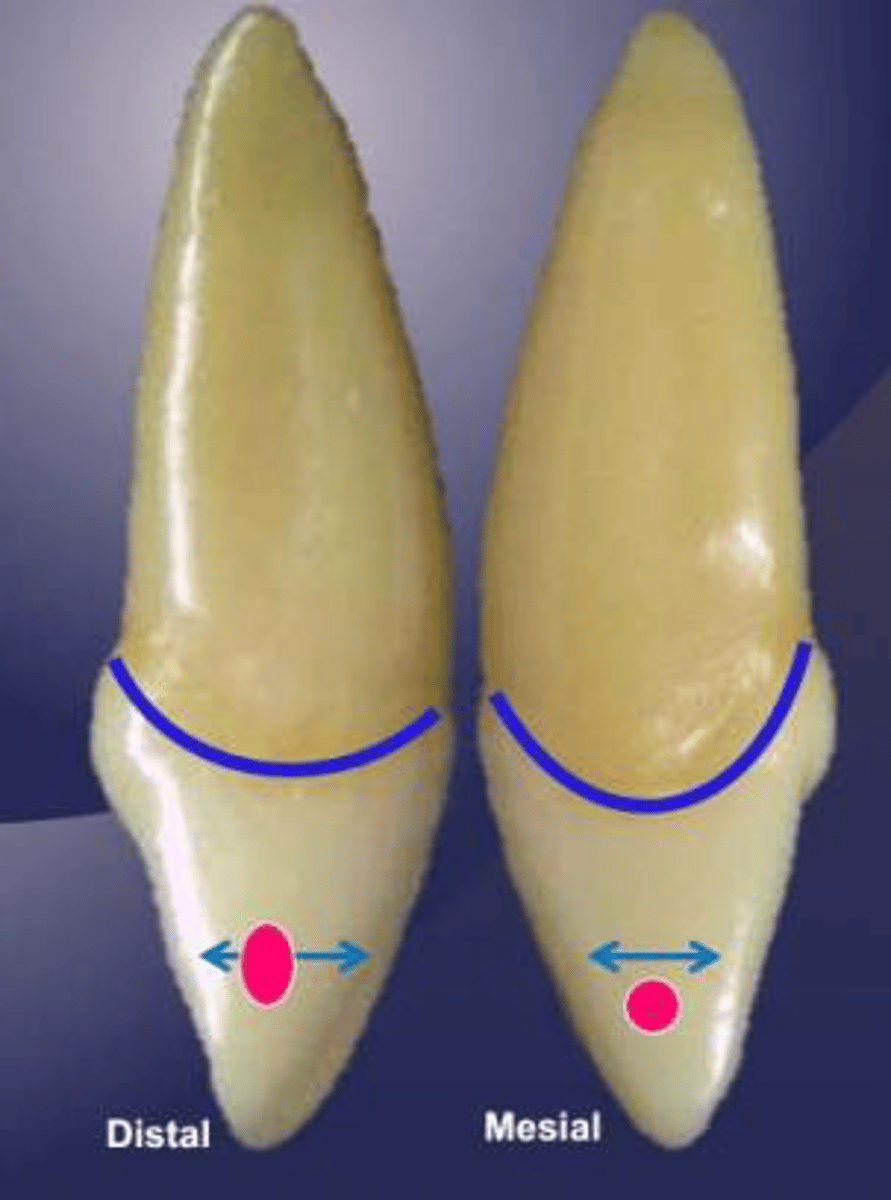 <p>what tooth is this?</p>